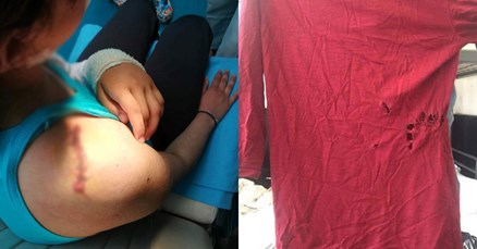 Ispovijest migranata u koje je pucala policija: Tražili smo hitnu, a policija nas je tukla