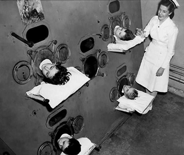 Djeca u “željeznim plućima” prije pojave cjepiva protiv dječje paralize. Mnoga su djeca mjesecima živjela u tim strojevima, iako nisu sva preživjela (1937. godina)