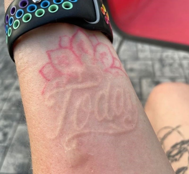 Ubo me komarac pored tetovaže i zbog toga su slova nabubrila u 3D