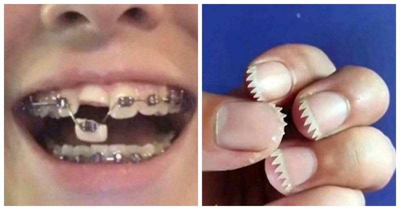 19 fotki za koje nećete znati jesu li vam više nelagodne ili smiješne. Svaka je gora od prethodne