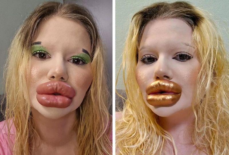 Također planira imati najveće jagodične kosti na svijetu