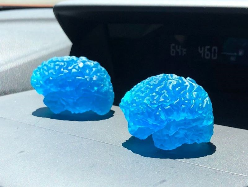 2. “Izvukla sam svoj i suprugov mozak iz MRI slika, a on ih je isprintao.”