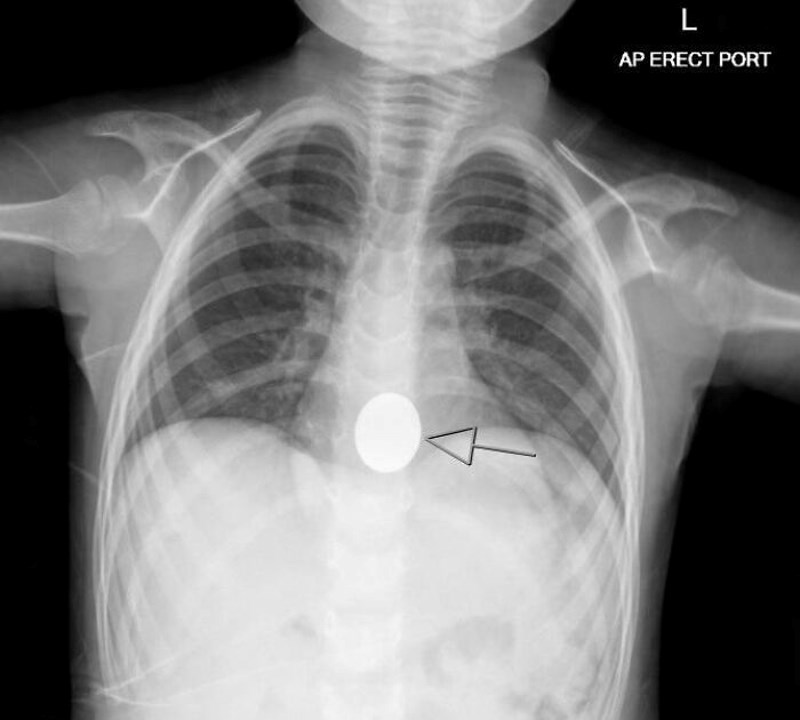 Izgubio sam Aldijevu kovanicu. Srećom, moj 4-godišnjak ju je pronašao i čuva ju na sigurnom mjestu