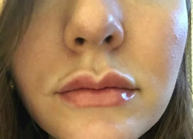 4.