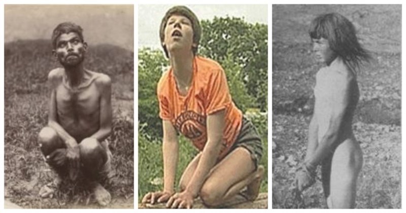 5 zastrašujuće bizarnih slučajeva djece odgajane od strane divljih životinja, ovo ledi krv u žilama