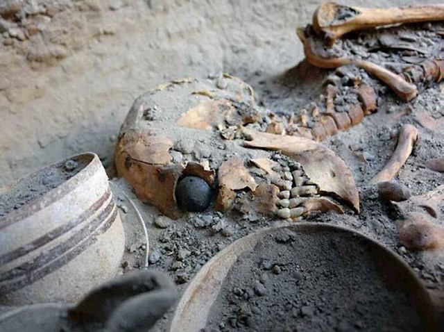 Prije više od 4800 godina, u Spaljenom gradu (Shahr-e Sukhteh) u pustinji Sistan (Iran), pokopana je žena s očnom protezom. Ovo je najstariji dosad pronađen primjer ovog pomagala