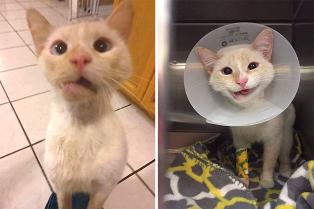 Prije i poslije operacije čeljusti