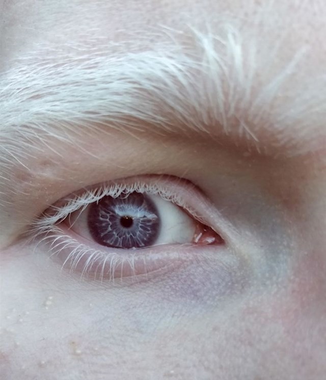 Ljepota albino ljudi.