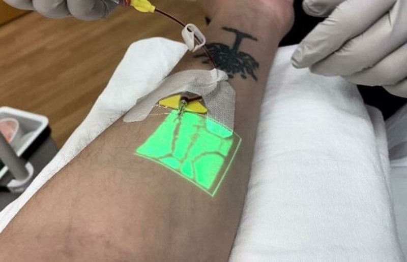 Medicinska sestra traži venu pomoću infracrvenog svjetla