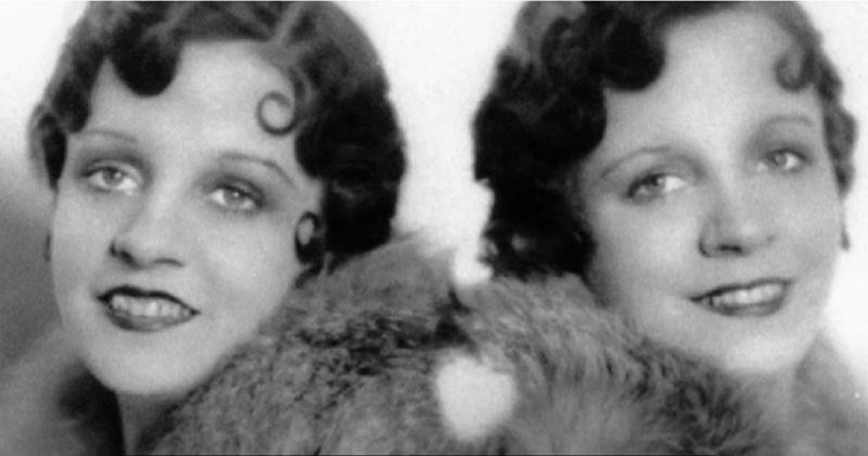 Strašna priča najpoznatijih sijamskih blizanki: Živjele su kao ropkinje, a okončale jezivom smrću