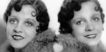 Strašna priča najpoznatijih sijamskih blizanki: Živjele su kao ropkinje, a okončale jezivom smrću