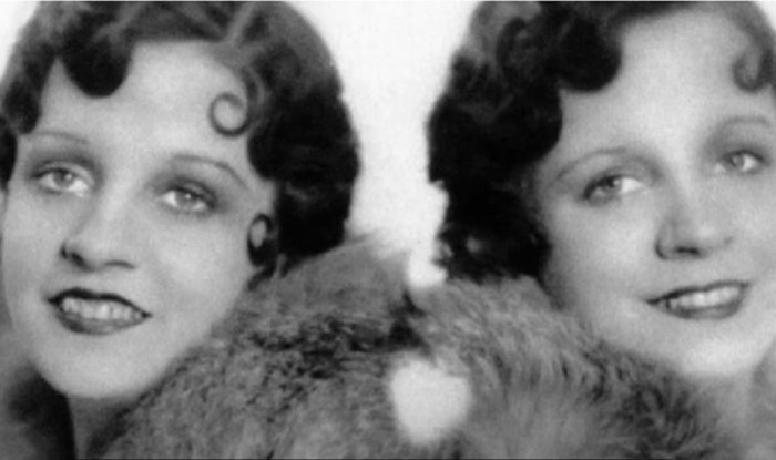 Strašna priča najpoznatijih sijamskih blizanki: Živjele su kao ropkinje, a okončale jezivom smrću