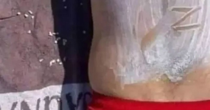 Žena ga je namazala zaštitnim faktorom, nakon nekoliko sati shvatio je što mu je zapravo napravila