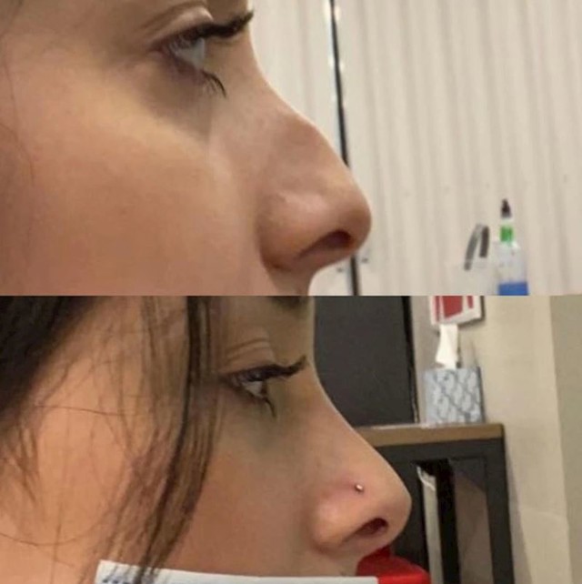 8.