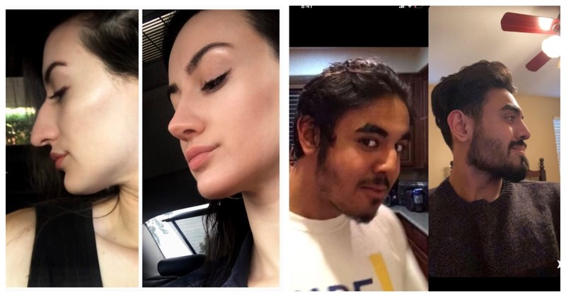 20 ljudi koji su uzeli sreću u svoje ruke, odlučili se na plastičnu kirurgiju i pobijedili