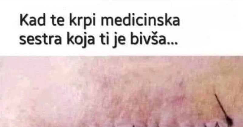 Završio je u bolnicu i naletio na bivšu koja je medicinska sestra. Rezultat situacije je SVE!