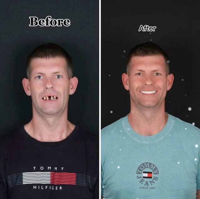 Transformacija koja oduzima dah
