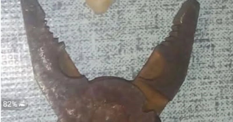 Bosanac se naljutio što mu zubar želi naplatiti vađenje zuba 40 KM, morate vidjeti što mu je poručio