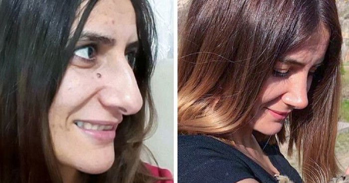 18 žena odvažilo se otići na dugo željene plastične operacije, sada jedino žale što nisu išle ranije