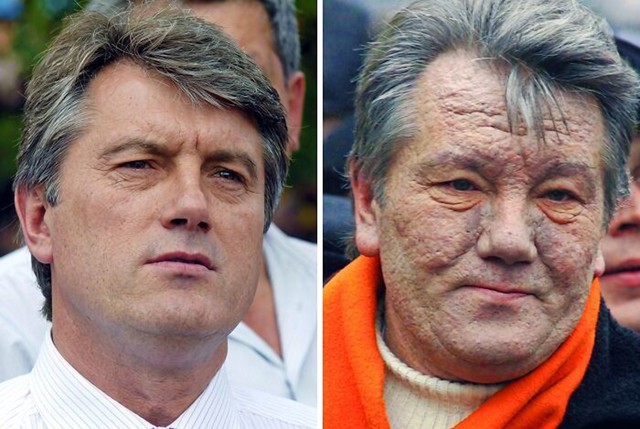 Političar koji je preživio trovanje