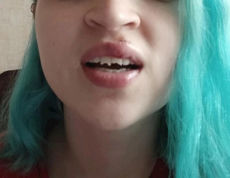 Dogodila mi se noćna mora! Pala sam zubima točno na asfalt!