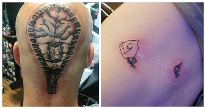 15 genijalnih tetovaža kojima su ovi ljudi prekrili ožiljke, ima ih baš zanimljivih
