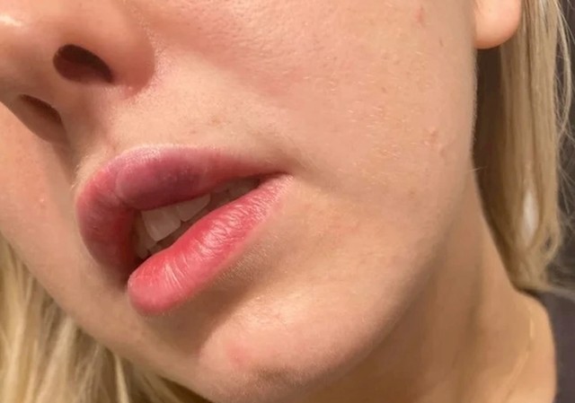 12.