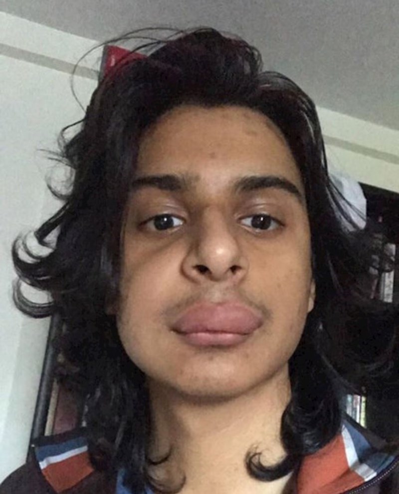 "Ubola me osa, a popodne imam razgovor za posao"