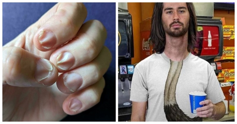 16 fotki koje ne prikazuju ništa strašno ni loše, ali svejedno će vam izazvati nelagodne trnce