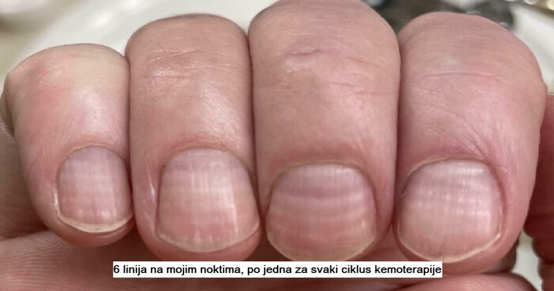 12 cool i zanimljivih fotografija koje pokazuju kako vrijeme mijenja stvari