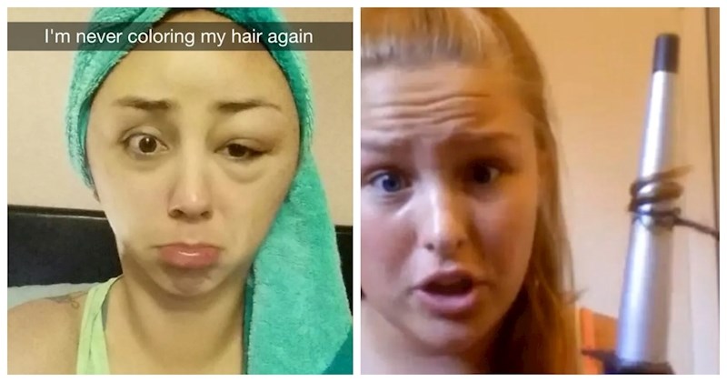 17 cura koje su na najteži mogući način saznale zašto se kaže da za ljepotu treba trpjeti