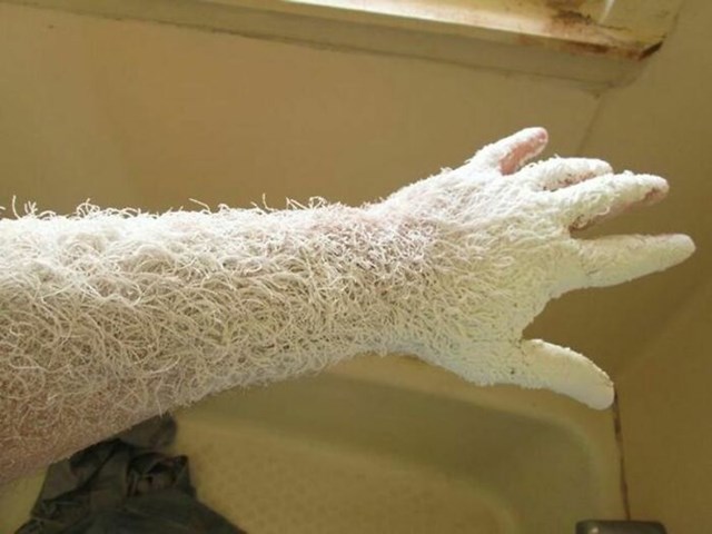 Ovako izgleda ruka nakon sat vremena brušenja drva