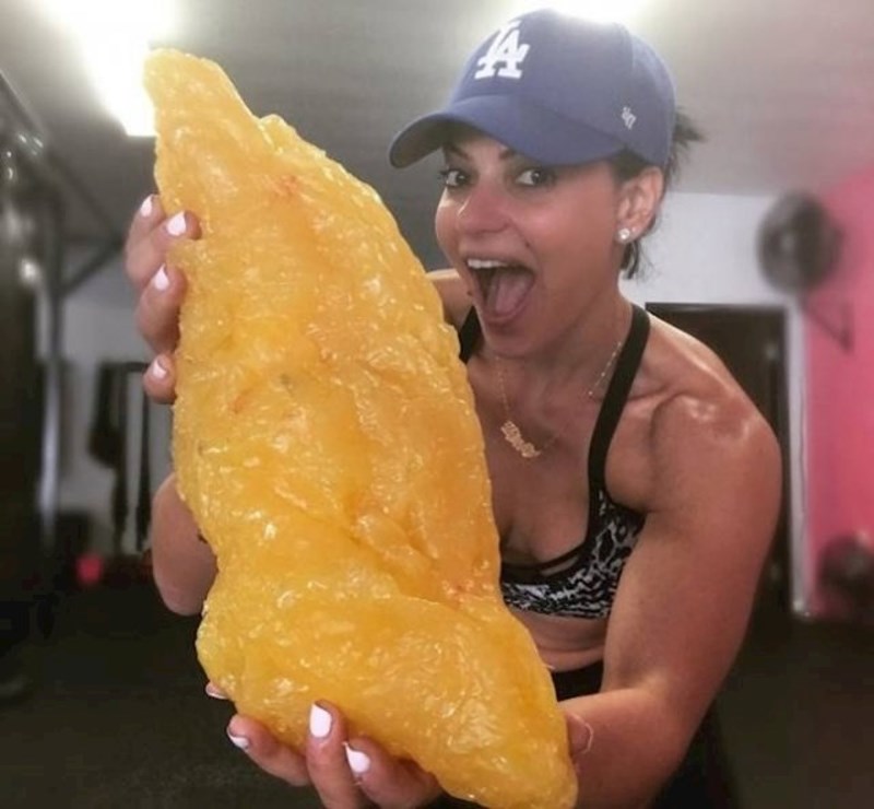 Ovako izgledaju 3 kilograma ljudskog sala.