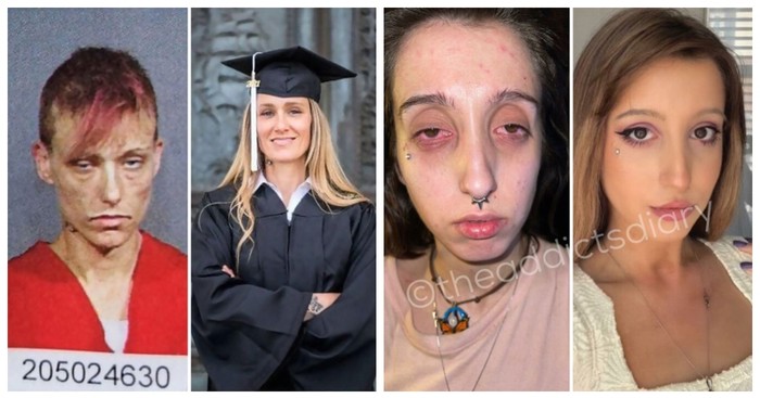 16 ljudi izvuklo se iz pakla droge, njihove "prije i poslije" slike nikoga ne ostavljaju ravnodušnim