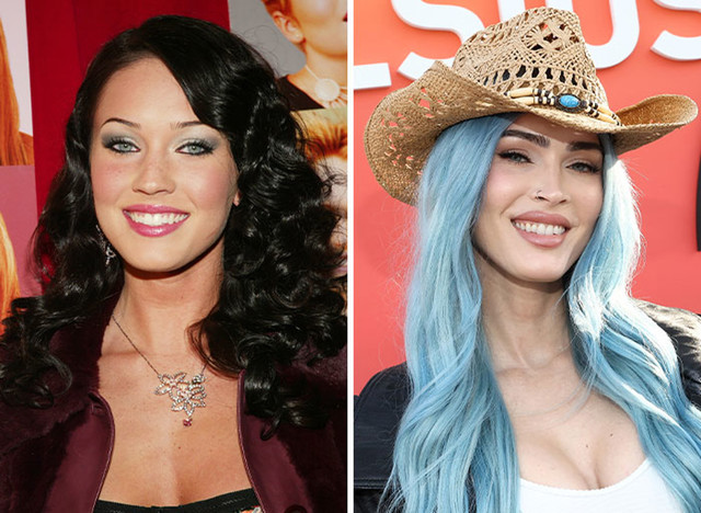 Megan Fox i brojne estetske operacije