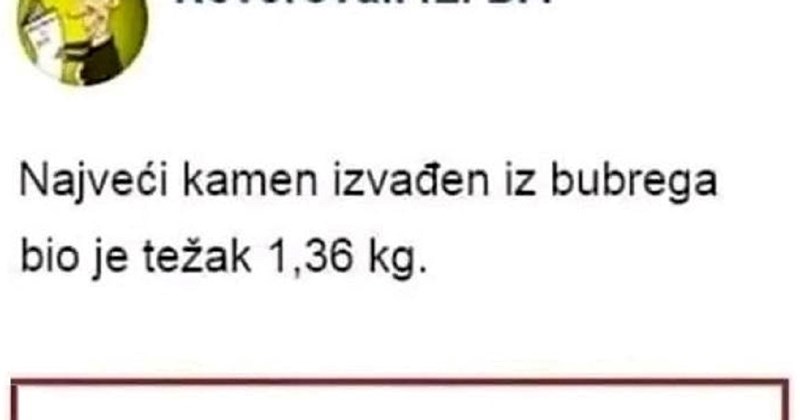 Zanimljivost o najvećem bubrežnom kamencu zasjenio je urnebesan komentar, morate vidjeti