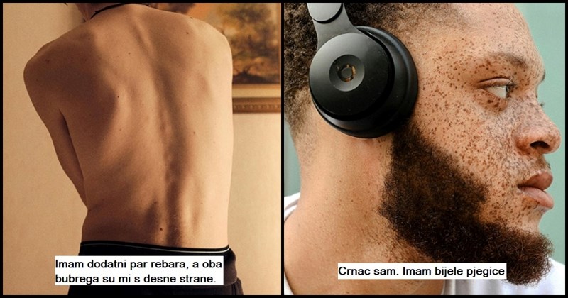 10 rijetkih tjelesnih karakteristika koje će vas fascinirati