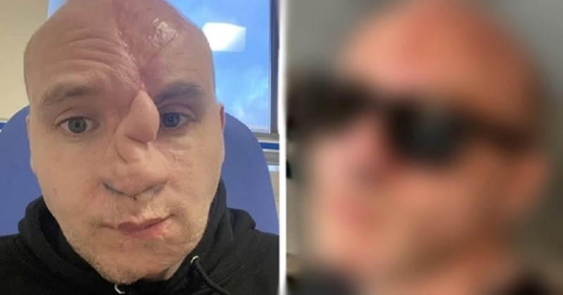 16 fascinantnih transformacija koje dokazuju da su kirurzi doslovno mađioničari