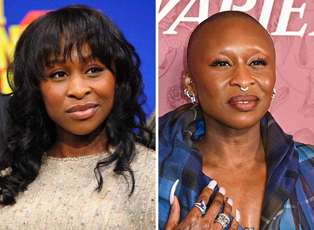 Cynthia Erivo i prihvaćanje ćelavosti