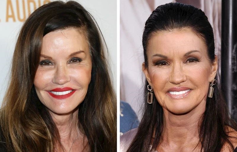 Janice Dickinson, 63