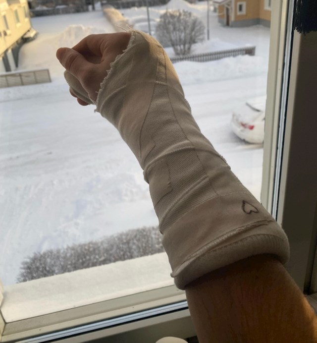 Danas sam trebala imati operaciju slomljene ruke, ali je kirurg koji me trebao operirati slomio nogu na skijanju