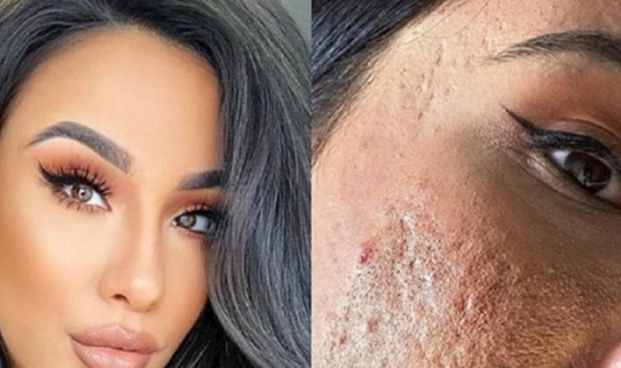 Instagram zvijezde su pokazale kako im lice izgleda bez šminke i filtera