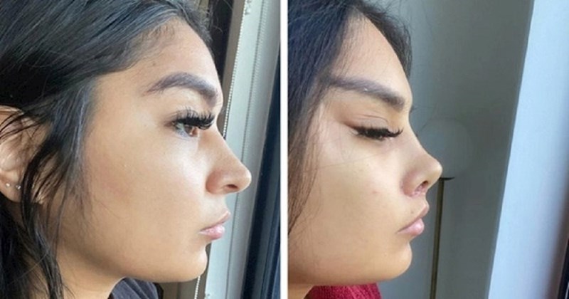 14 ljudi koji su odlučili promijeniti svoj izgled i sada bi dali sve da se mogu vratiti na staro