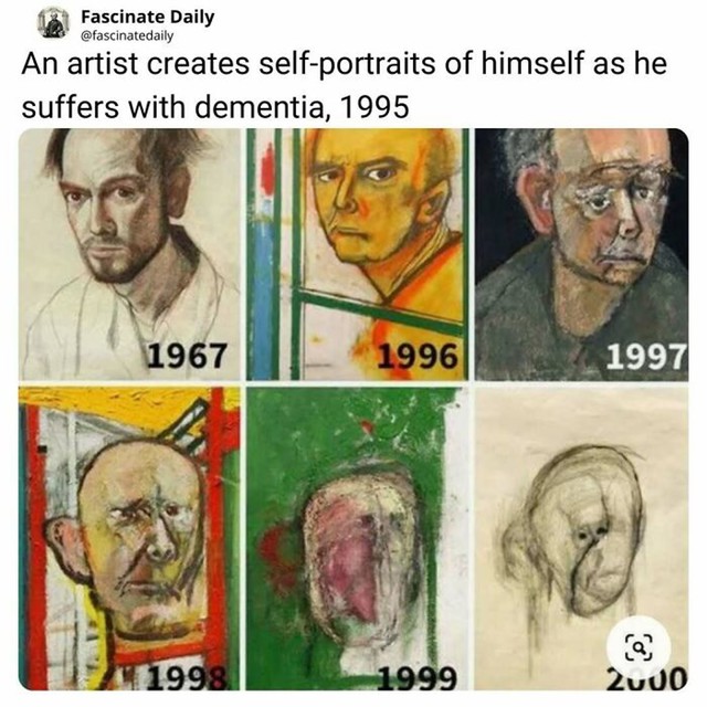 Umjetnost kao prikaz progresivne demencije