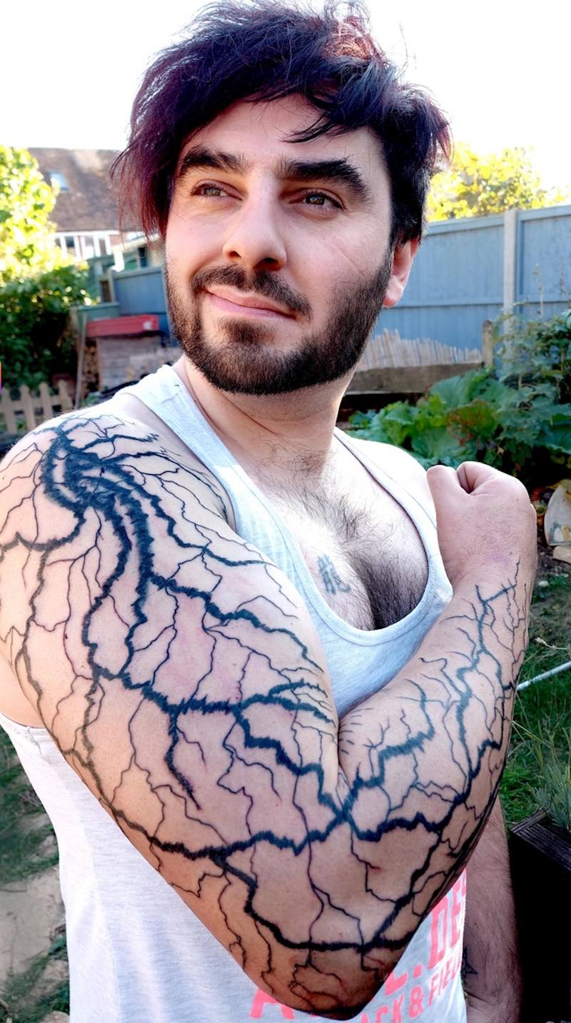 Pogodio me grom i nekim čudom sam preživio. Ožiljak sam tetovirao da mi bude vječni podsjetnik