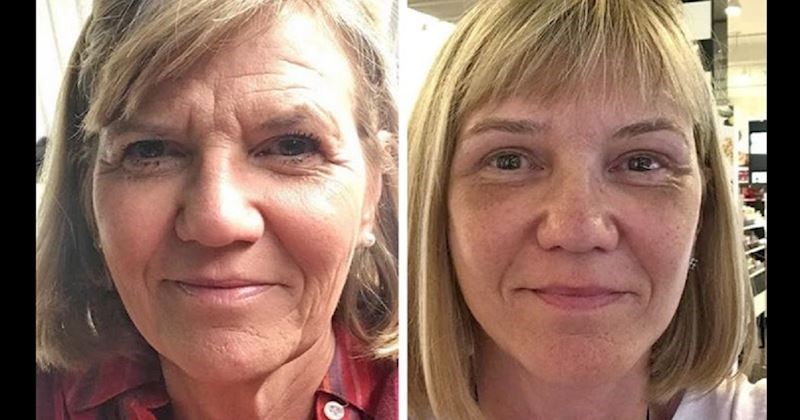 15 cura odvažilo se na dugo željene korekcije i jedino za čim žale je što to nisu napravile ranije