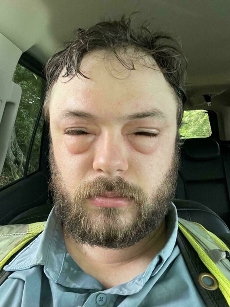 Susjed je polijevao vrt sredstvom na koje sam alergičan