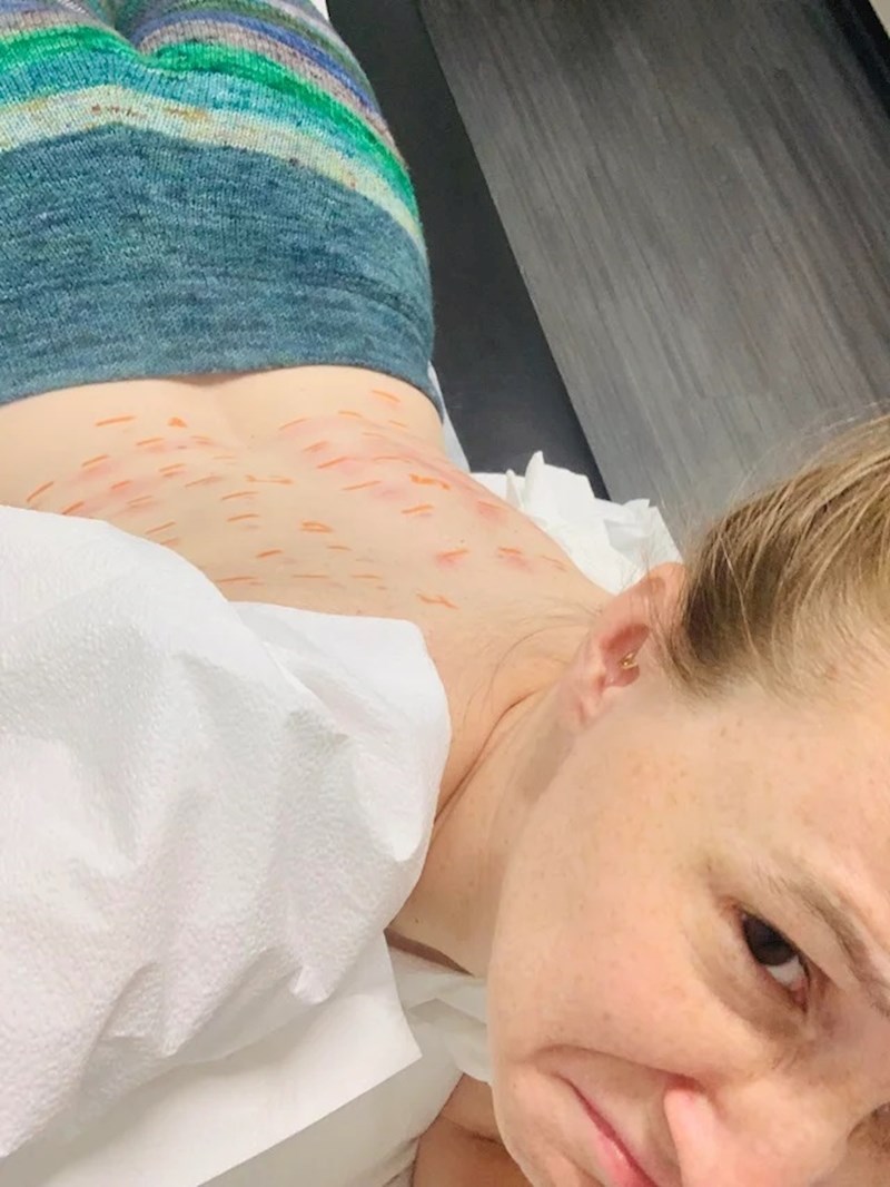 Alergična sam na svijet oko sebe, doslovno