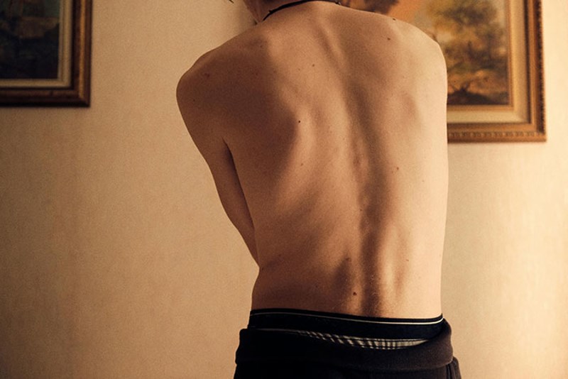 Imam dodatni par rebara, a oba bubrega su mi s desne strane.