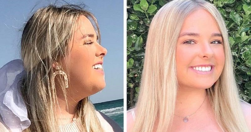 15 ljudi koji su se odlučili podvrgnuti plastičnoj operaciji i nikad se nisu osvrnuli